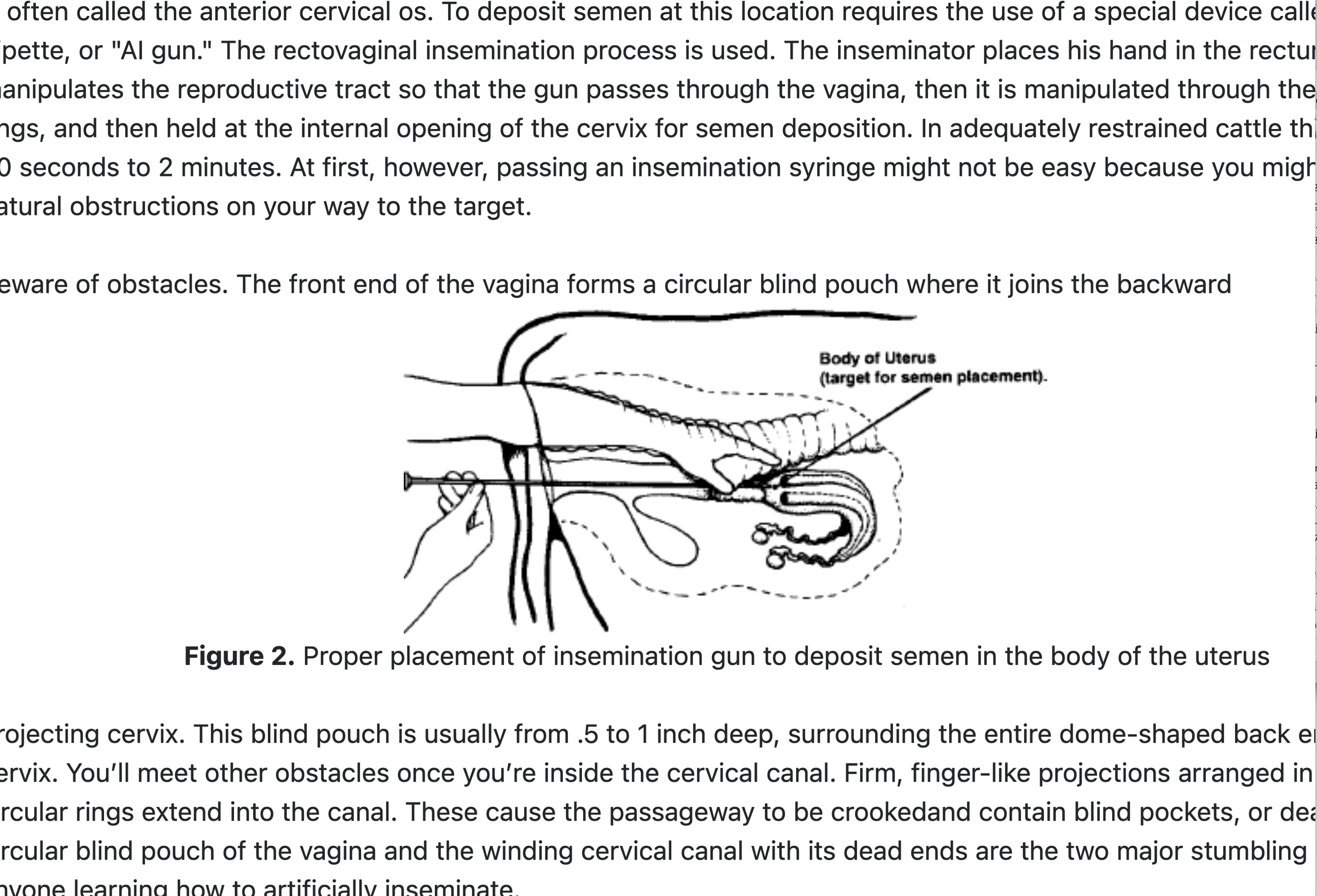 Diagram of the proper placement of insemination gun to deposit semen into the body of the uterus